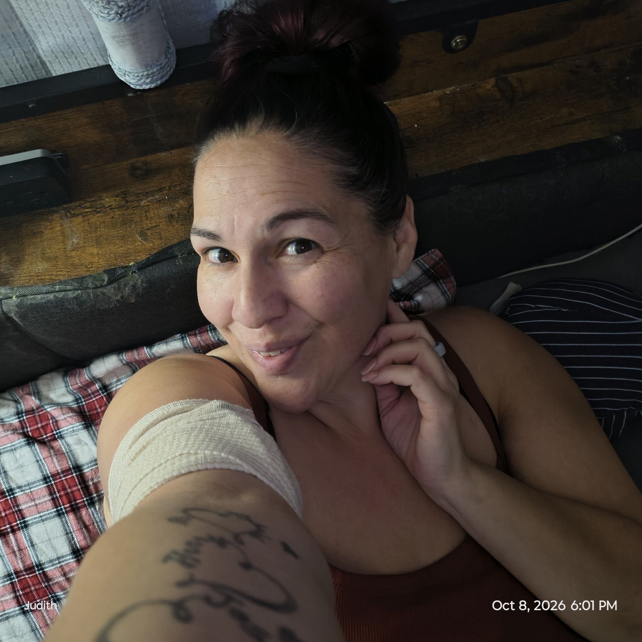 Bariatric Surgery Support Group | I am two days post op and still in ...