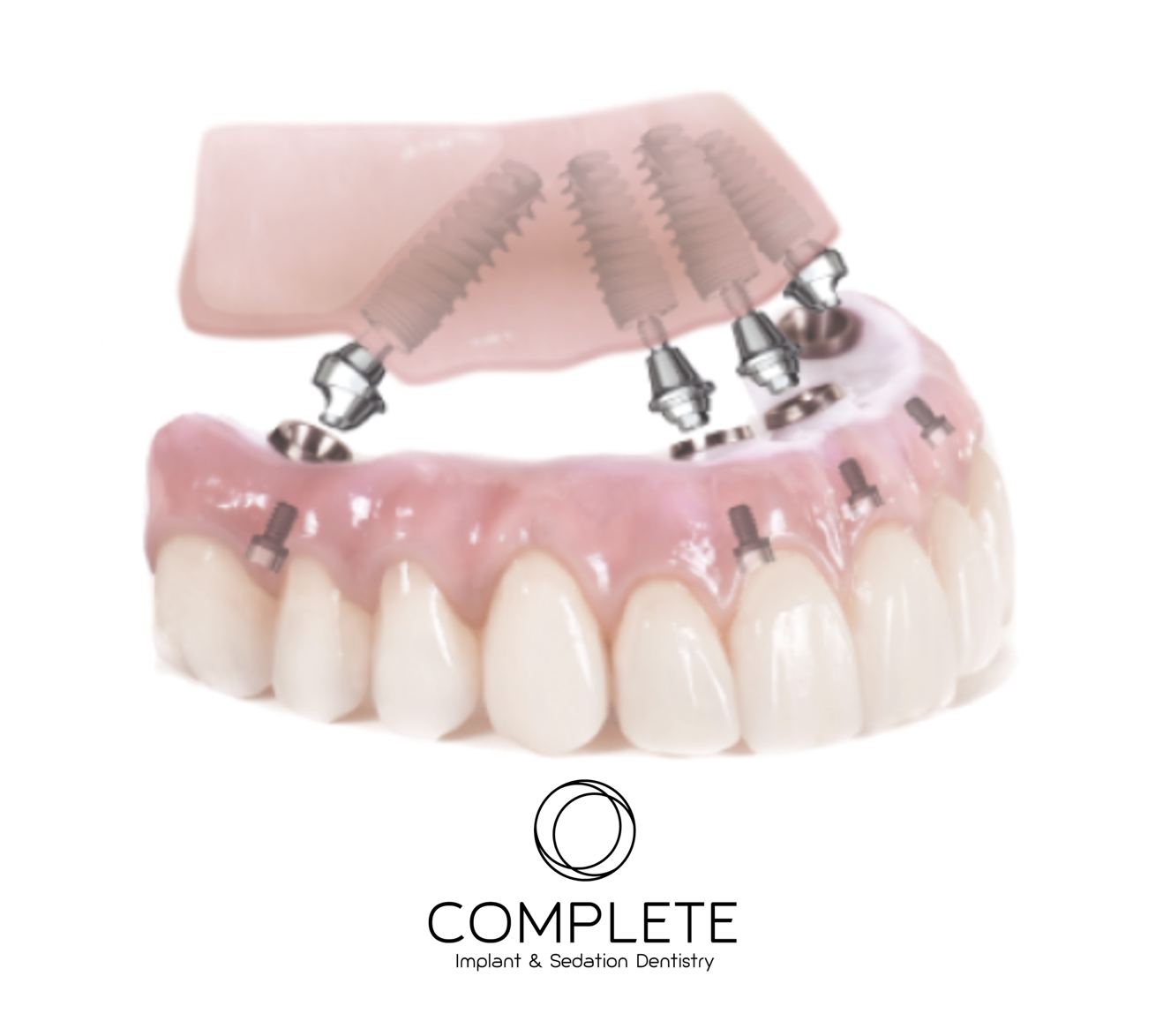 Complete Implant & Sedation Dentistry - Perth All On 4 Clinic