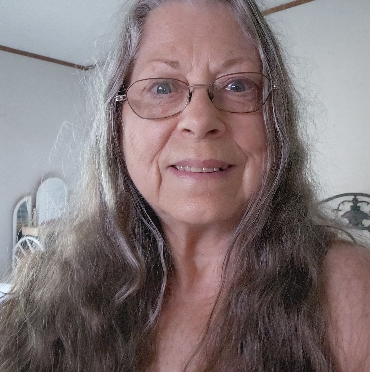 Any one get itchy skin with fibromyalgia | Facebook