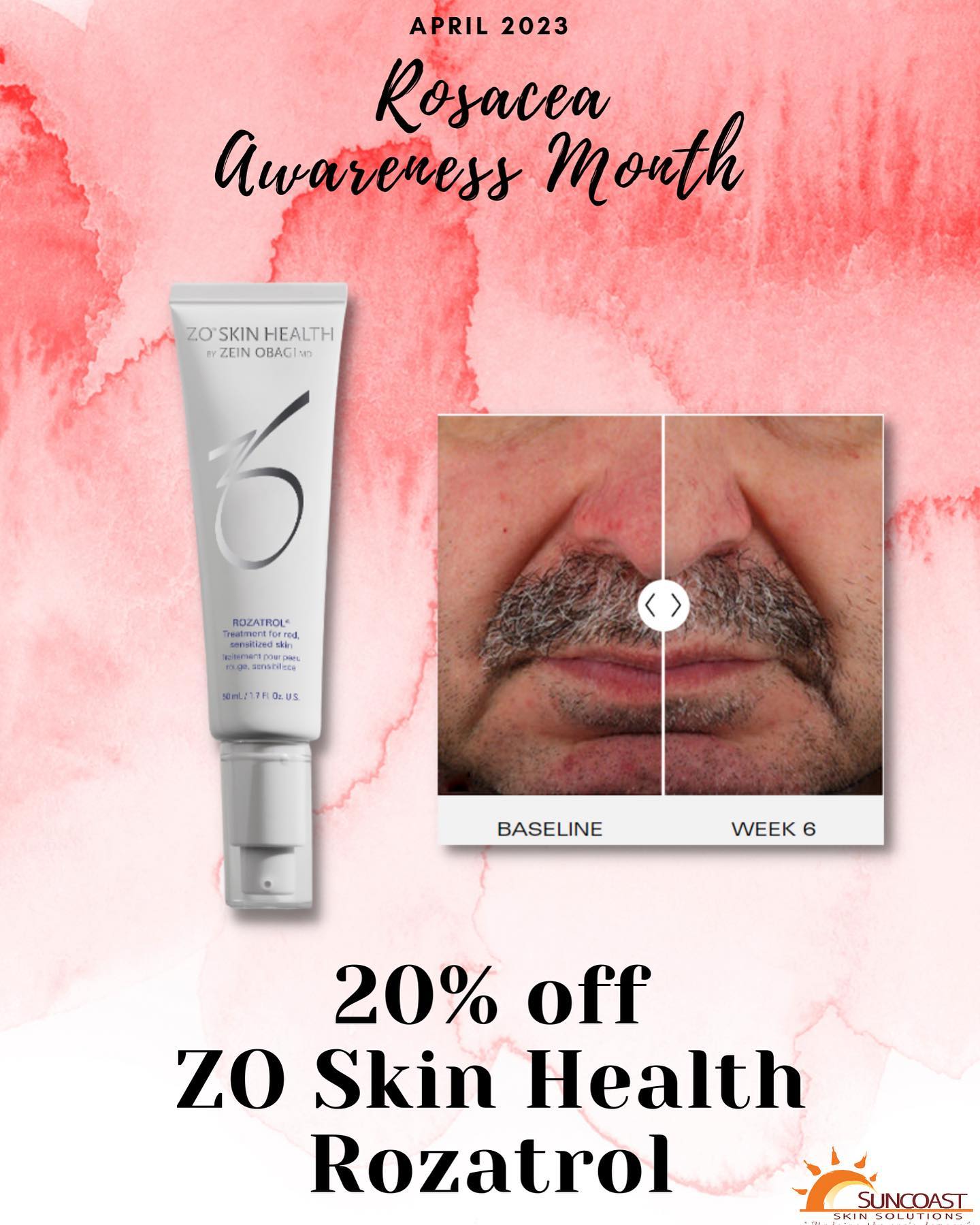 Rozatrol serum for redness relief and balanced complexion