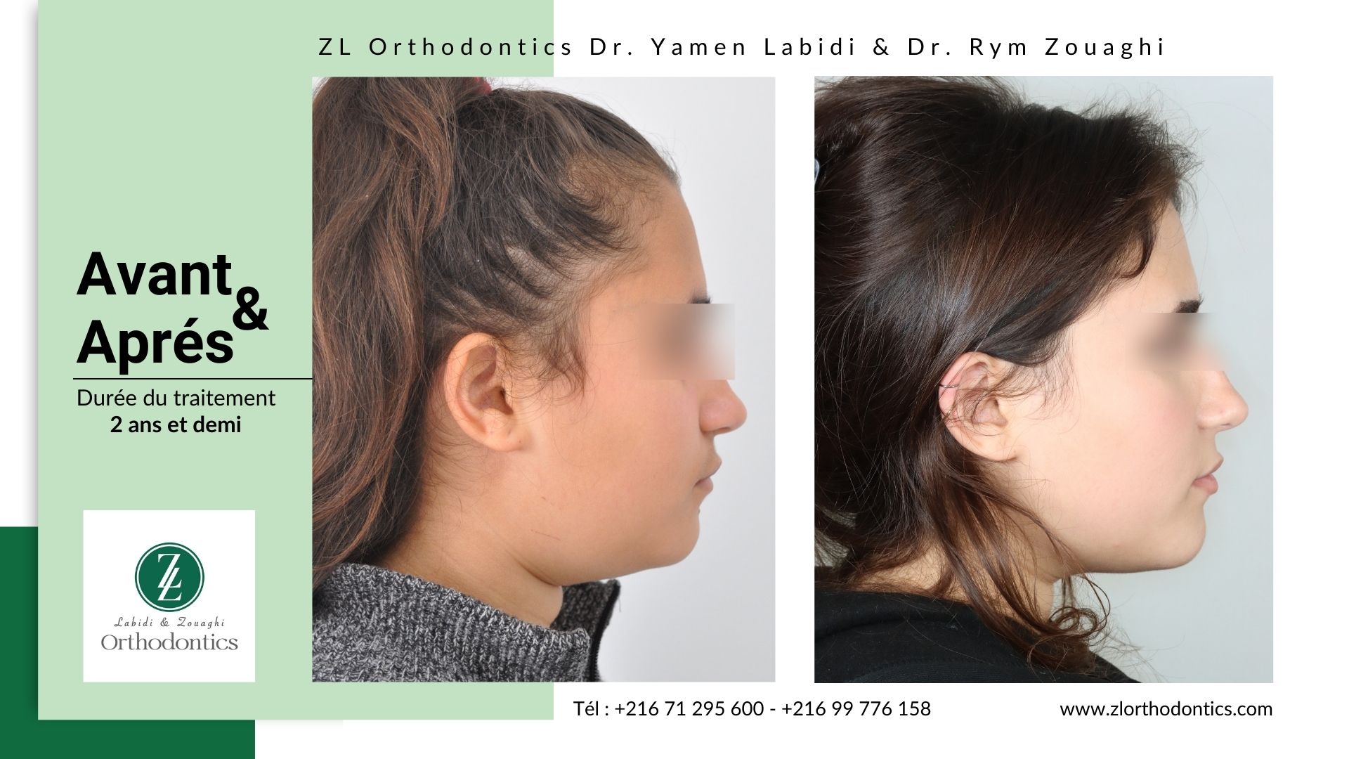 ZL Orthodontics - Dr. Yamen Labidi & Dr. Rym Zouaghi | Mégrine