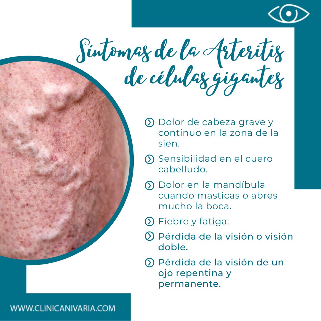 Clínica Nivaria - ¿CUÁLES SON LOS SÍNTOMAS DE LA ARTERITIS...
