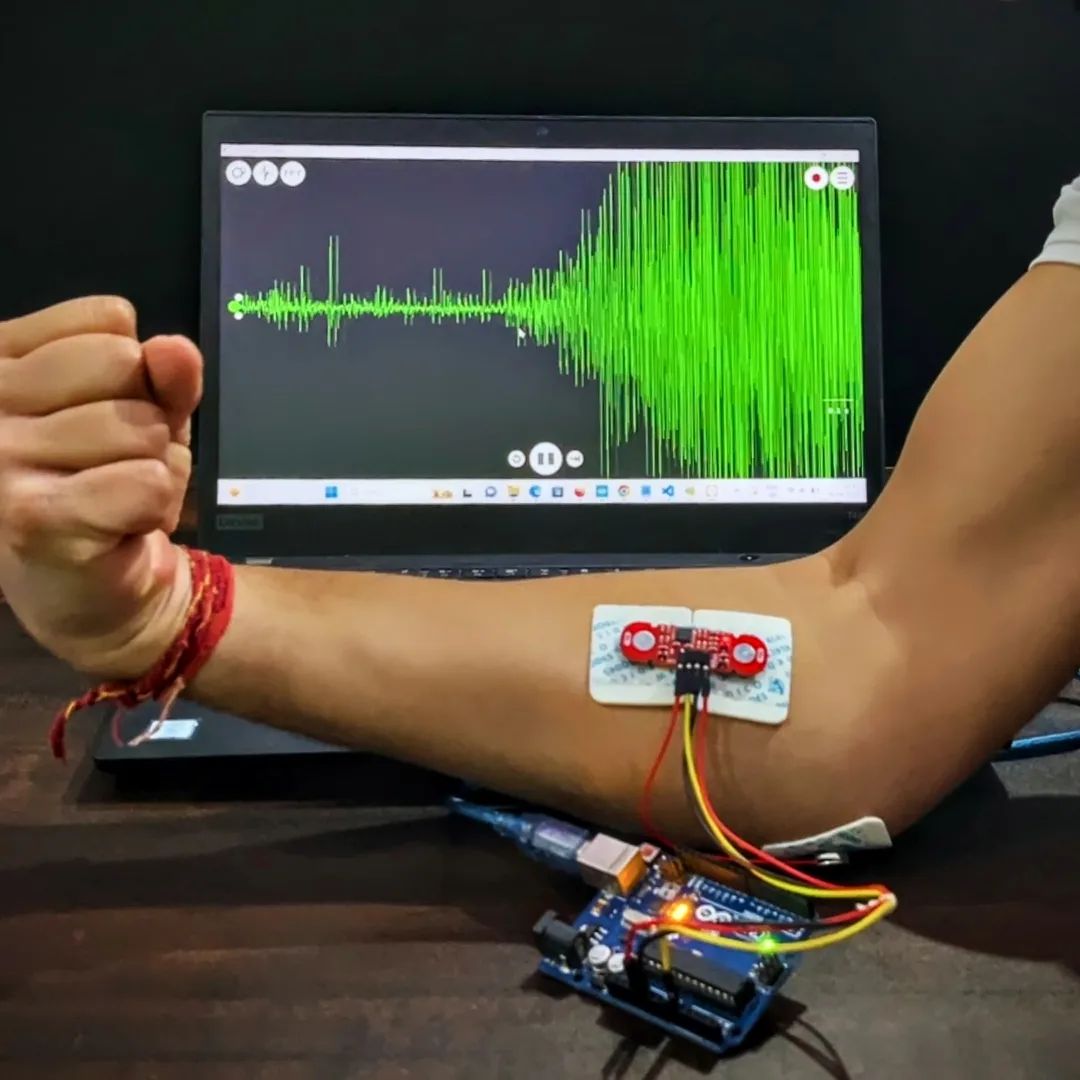 Electronic Projects | Measuring muscle signals (EMG) using our wearable ...