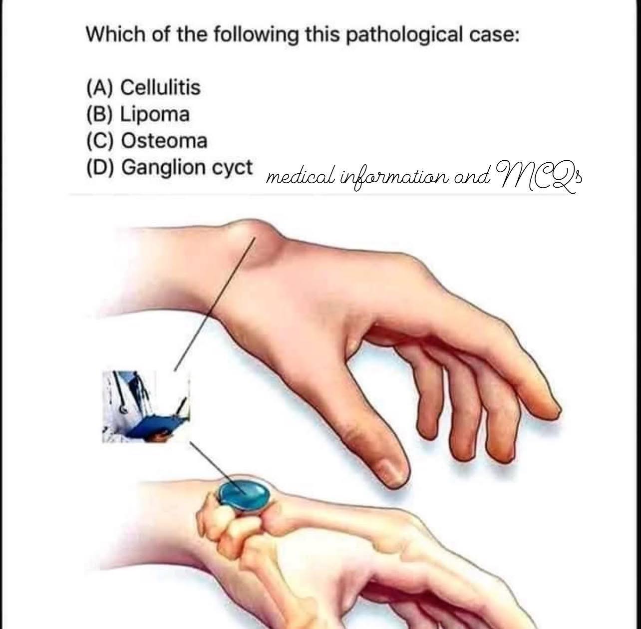 Medical information and MCQS | Facebook