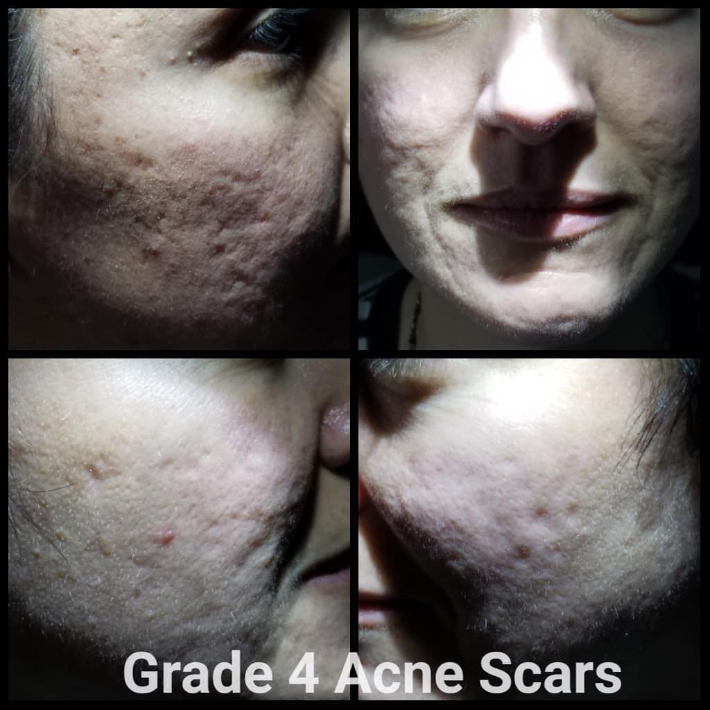 The treatment that... - Rejuvimed Advanced Medical Aesthetics | Facebook