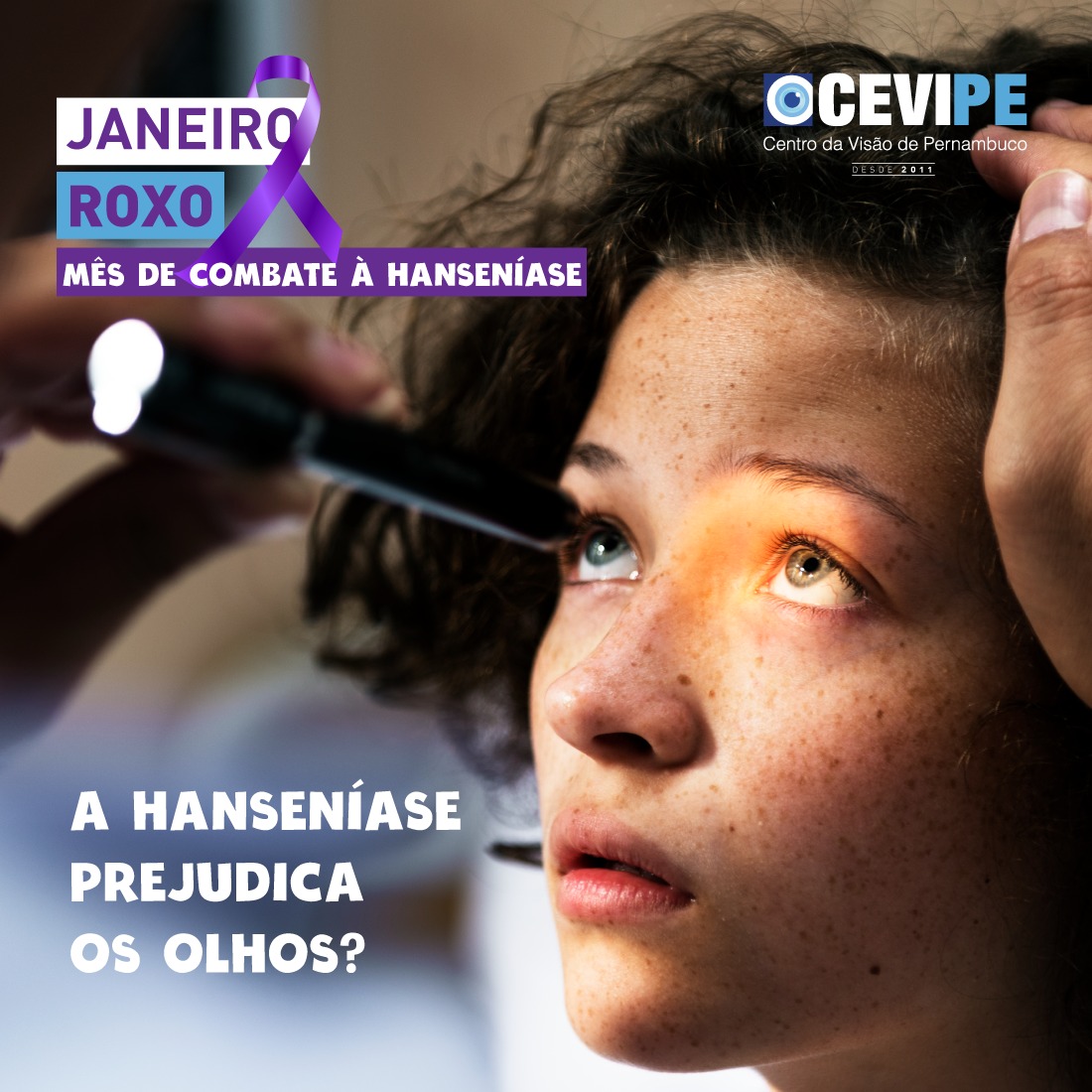 A hanseníase é... - CEVIPE - Centro da Visão de Pernambuco | Facebook