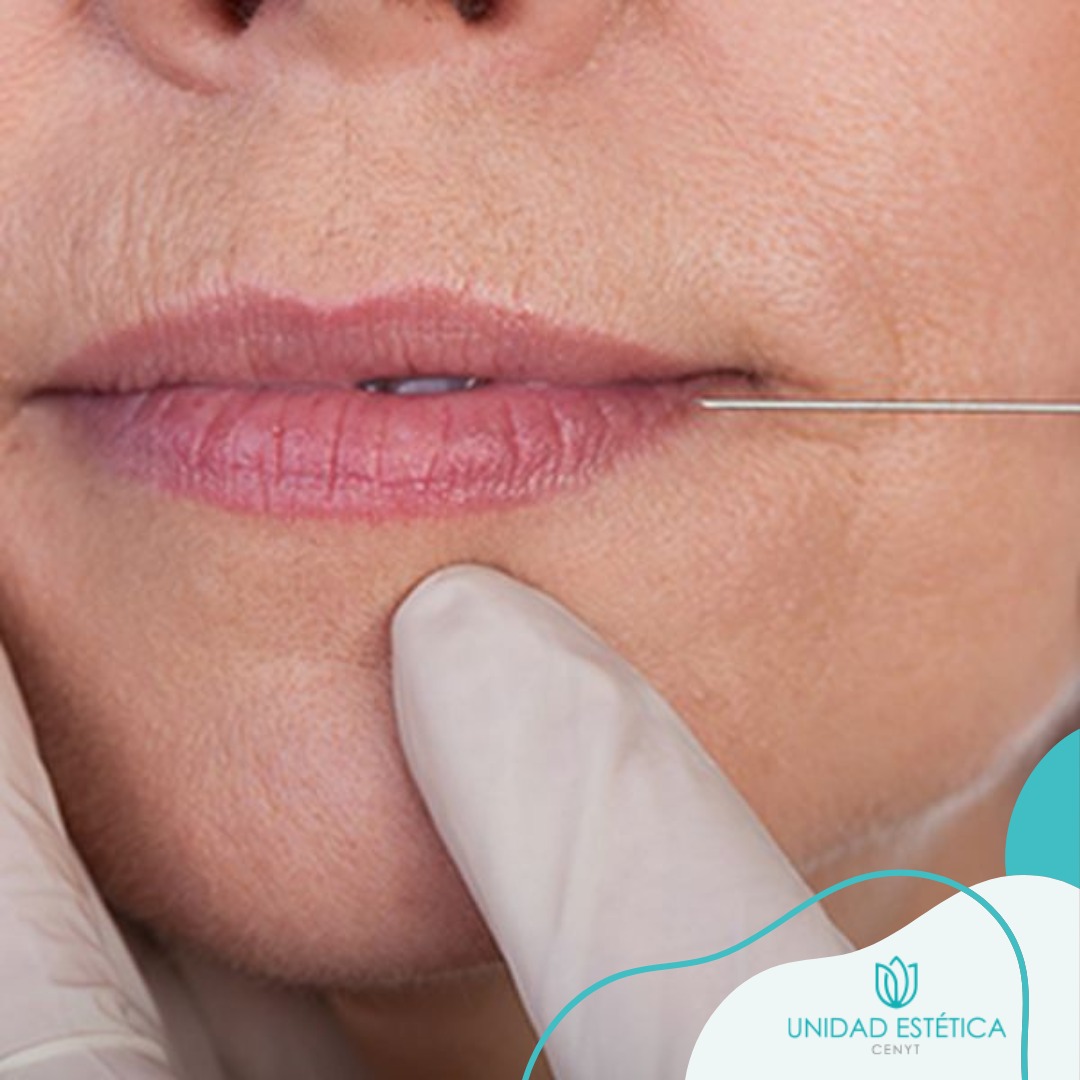 Cenyt - 👄El código de barras es como se conoce comúnmente al conjunto ...