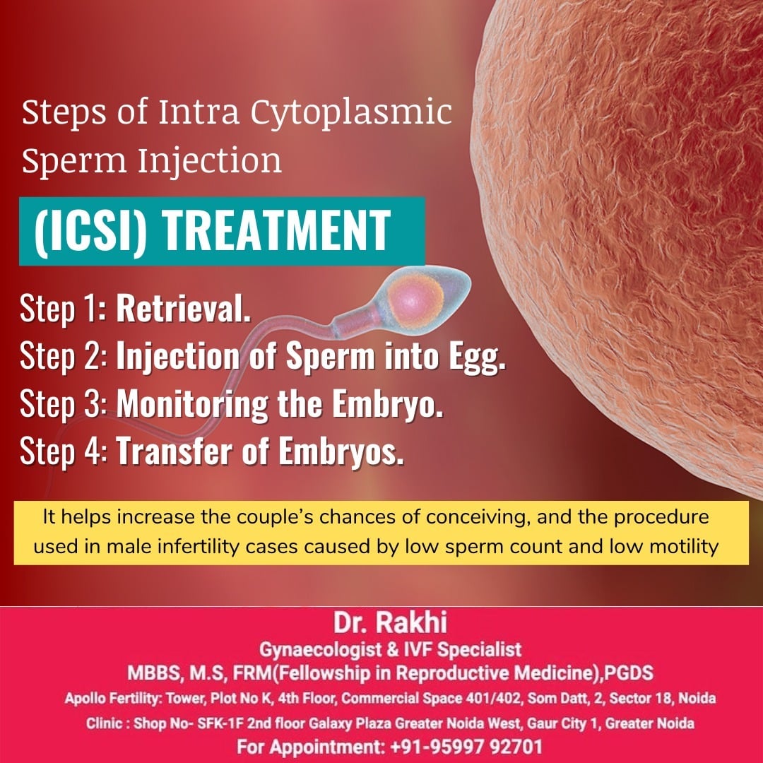Dr. Rakhi - The Intracytoplasmic Sperm Injection (ICSI)...
