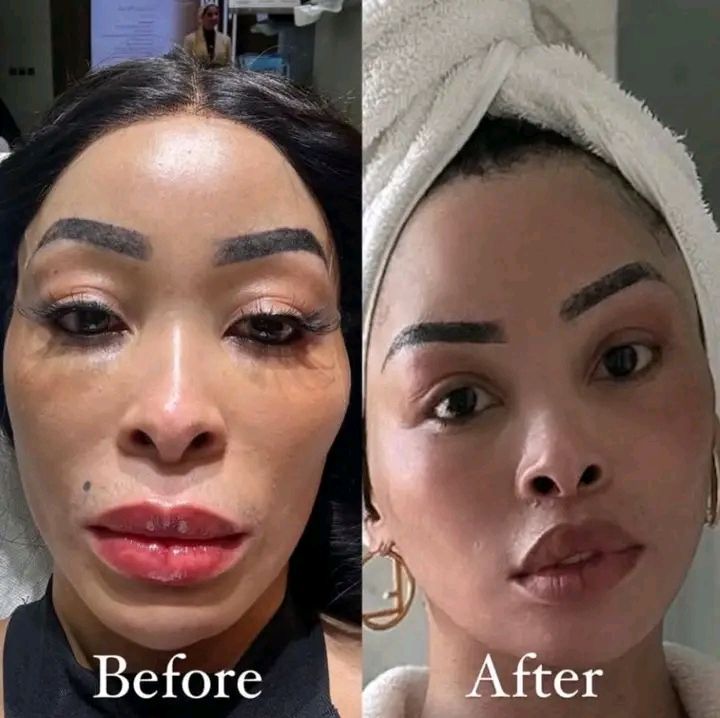 khanyi mbau skin lightening glutathione injections I look better lighter'  on her transformation Khanyi Mbau addresses skin lightening