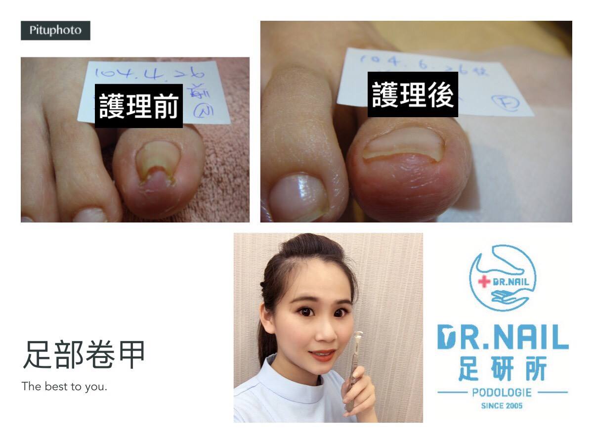 以下照片為【Dr.Nail 足研所】版權所有，不得擅自下載使用 ... - B/S Spange Taiwan