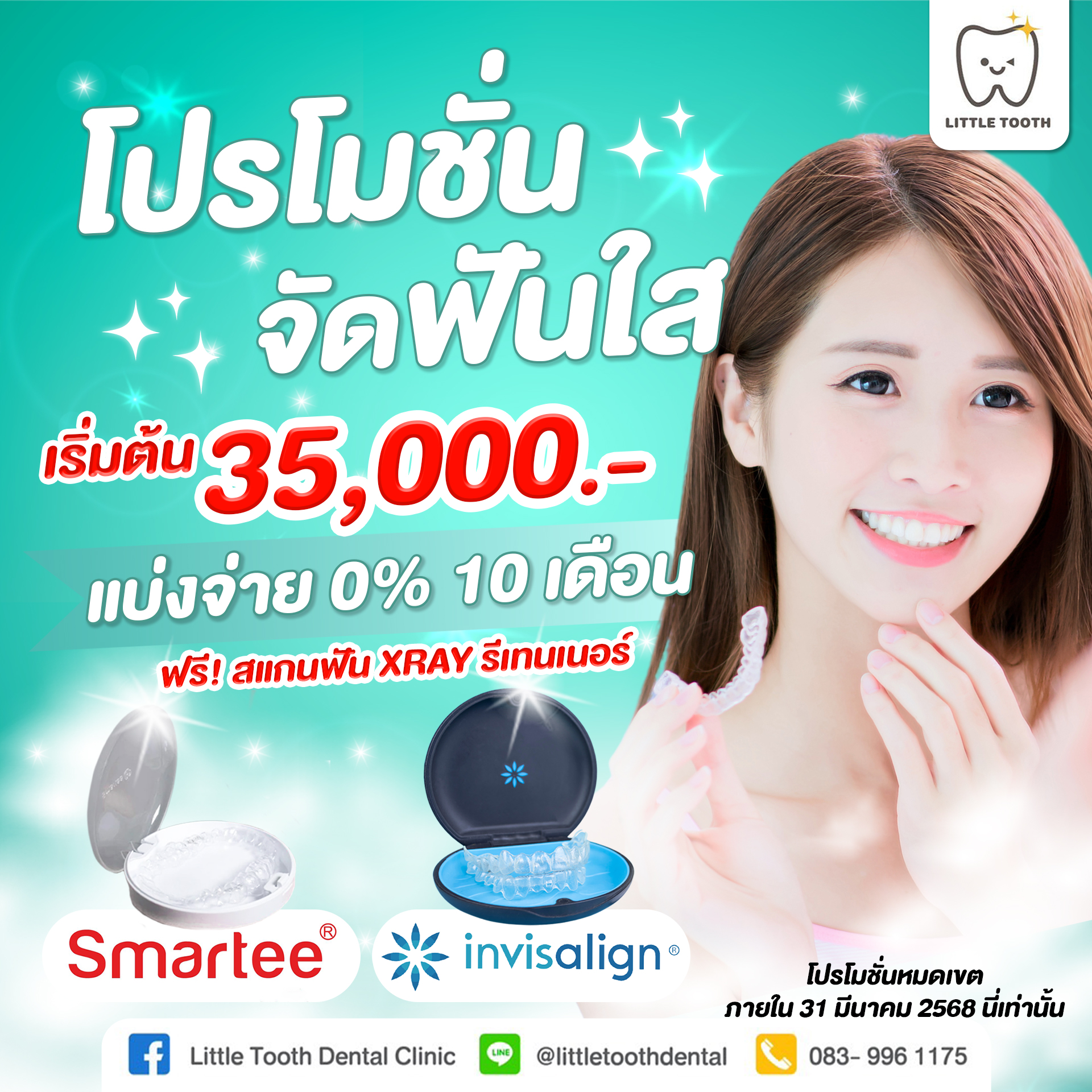 📢 จัดฟันใส สุดคุ้ม! Invisalign หรือ Smartee เริ่มต้น 35,000.- 💳 ผ่อน ...