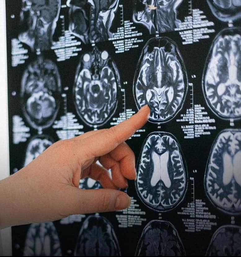 HBMtv - New study finds CTE in 40% of athletes who died... | Facebook
