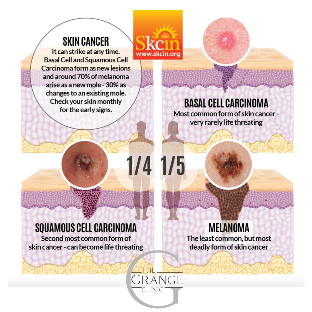 Did you know that there are different... - The Grange Clinic | Facebook
