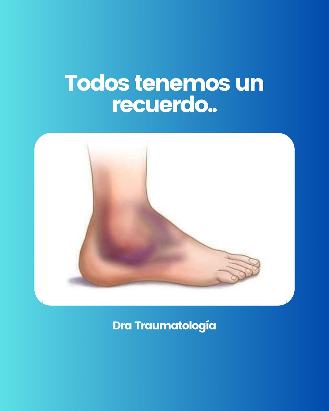Dra - La tendinitis rotuliana es una lesión en el tendón que conecta la ...