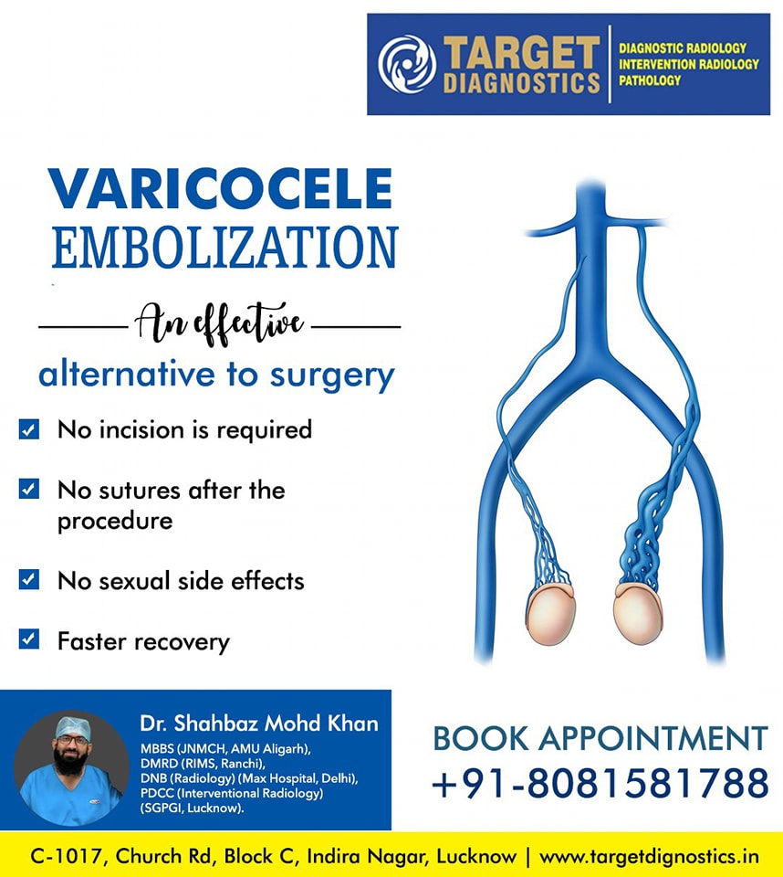 l-carnitine treatment varicocele What are options for varicocele? Size:Half Set Thiamine Injection Thiamine (Vitamin skincare-collection