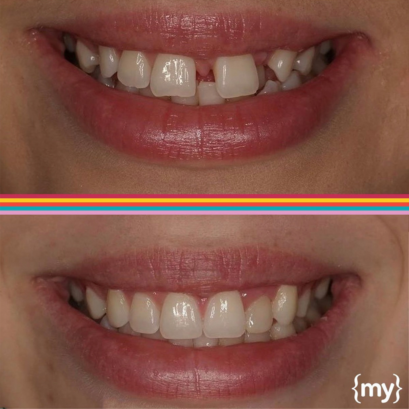 mysmileuk