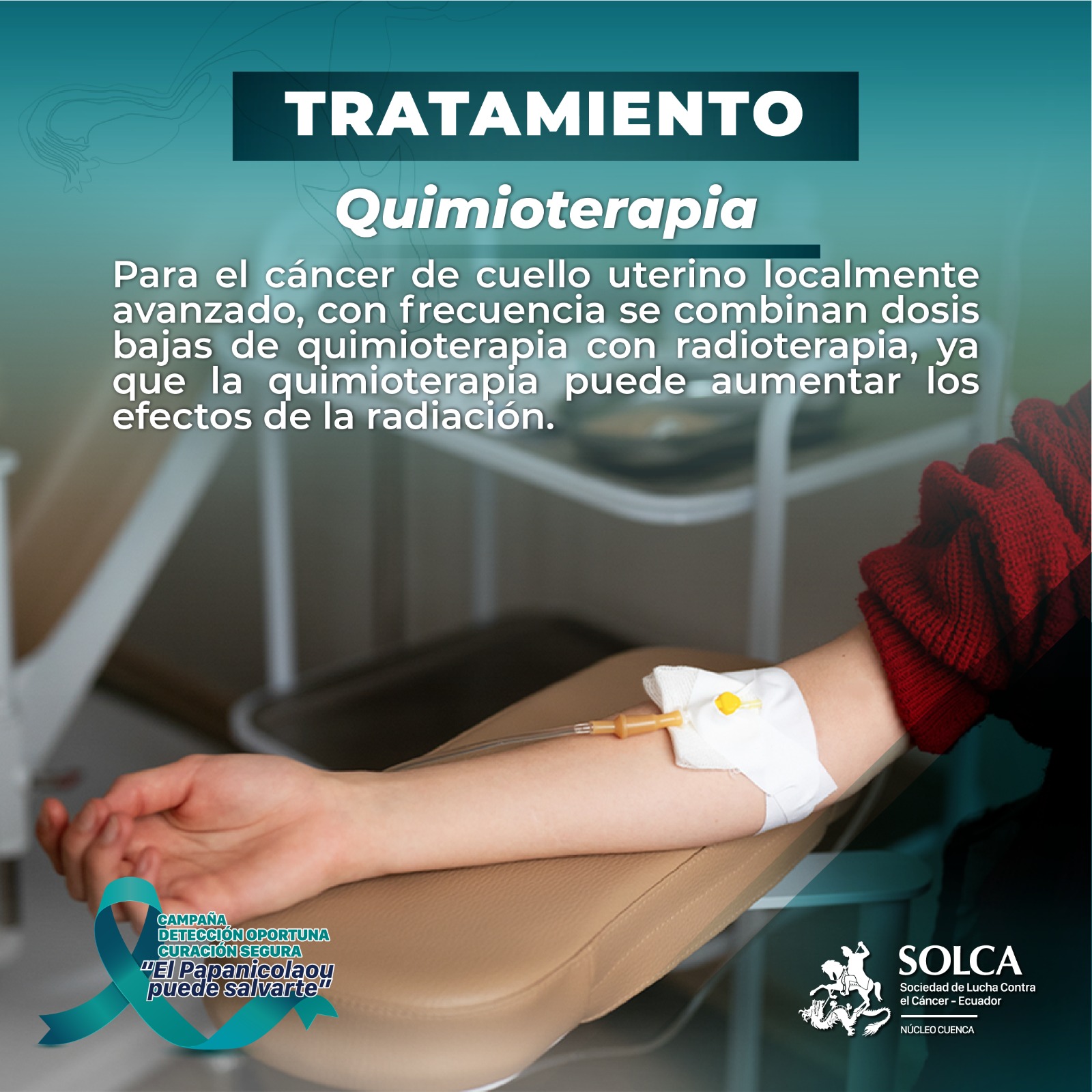 ¿Qué es la... - Instituto del Cáncer SOLCA Cuenca