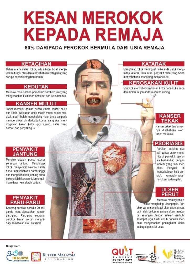 NCIG Mutiara Rini