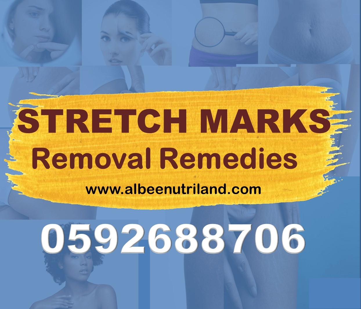 Stretch Marks Cream in Ghana Accra