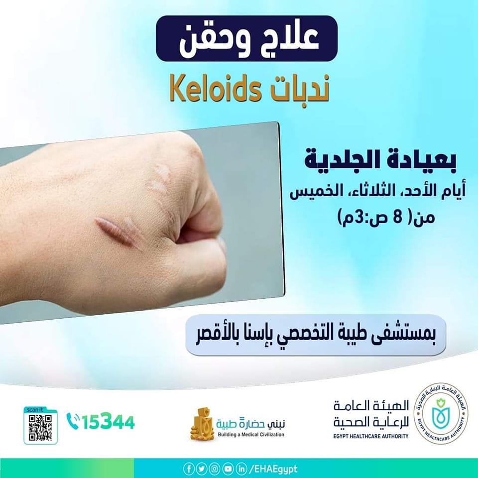 Tiba Specialized Hospital - مستشفى طيبه التخصصى - ندبات Keloids أو(ندبة ...