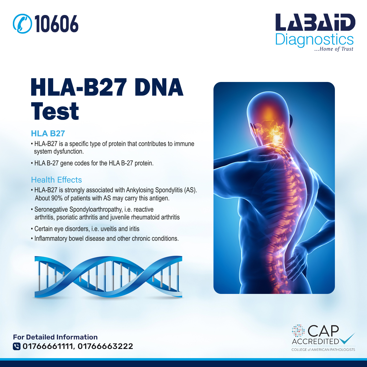Labaid - HLAB-27 is a specific type of protein that contributes to ...