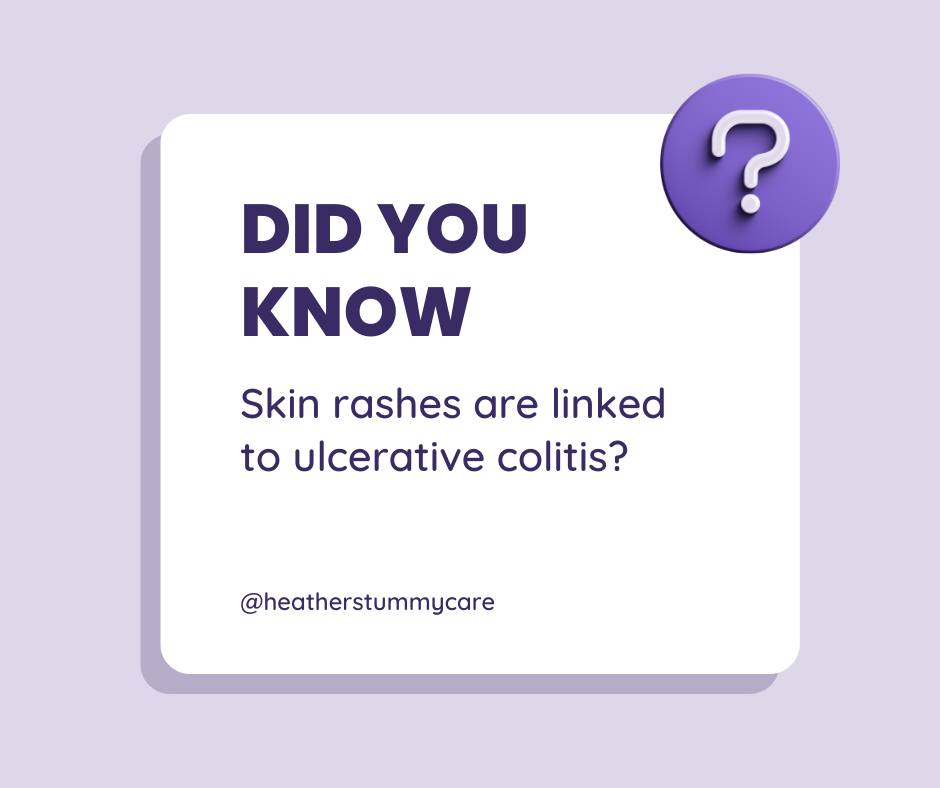 The inappropriate immune response that underlies ulcerative colitis ...