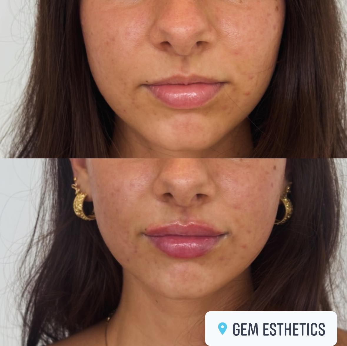 Gem - Spot the Difference! Are you ready to turn your dream face into a ...