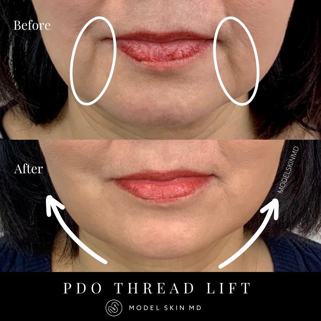 Model Skin MD | Vancouver BC