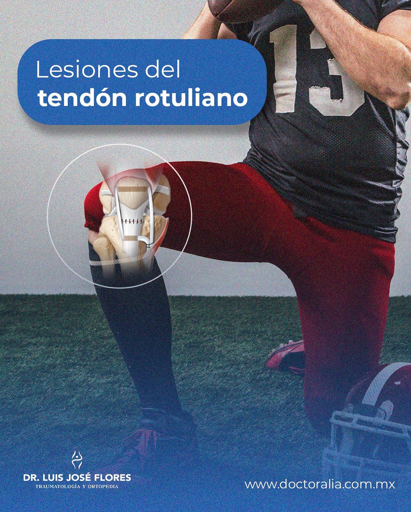Dr. - 🦵 Lesiones del tendón rotuliano🏈 El tendón rotuliano conecta la ...