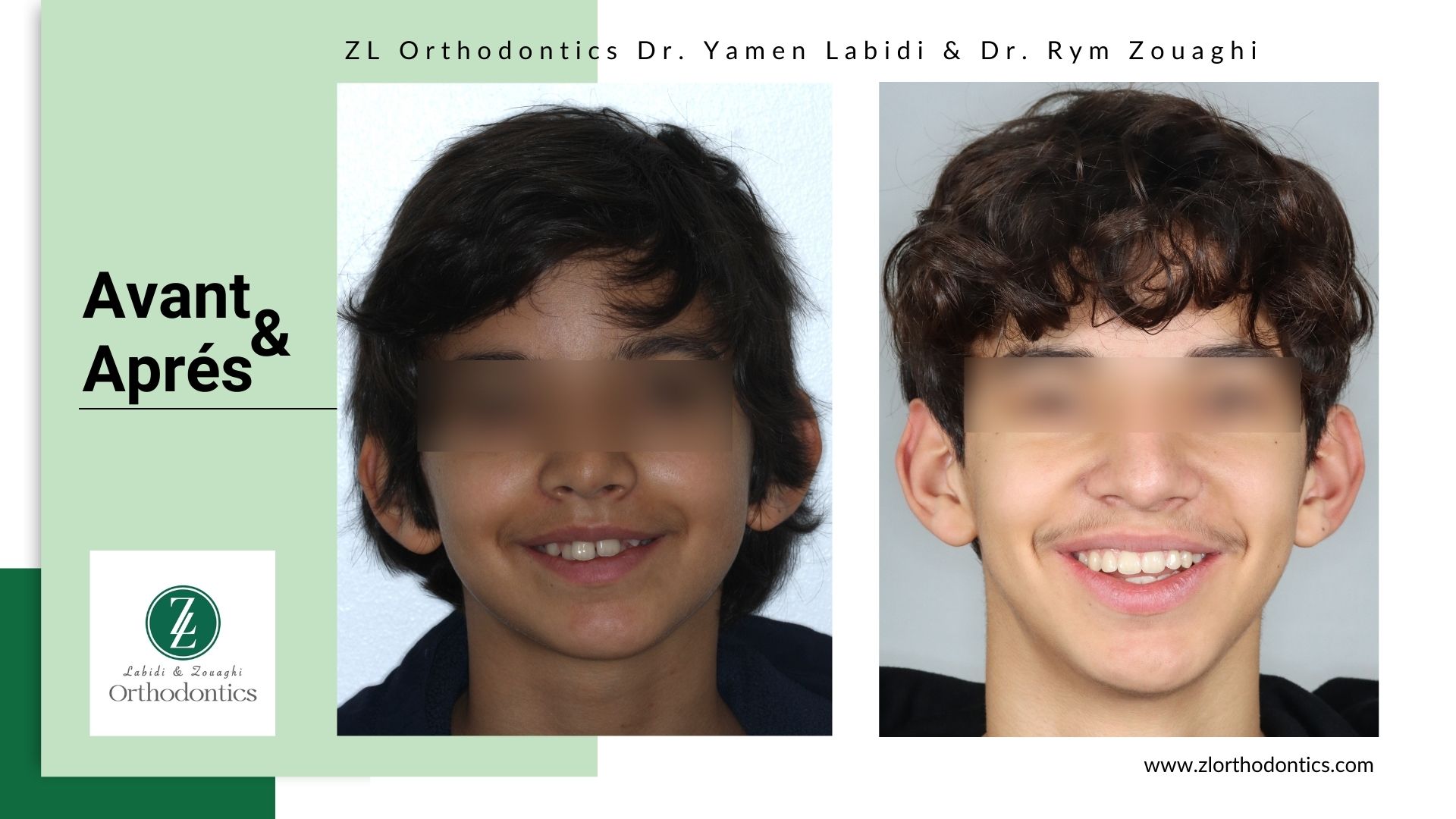 ZL Orthodontics - Dr. Yamen Labidi & Dr. Rym Zouaghi | Mégrine