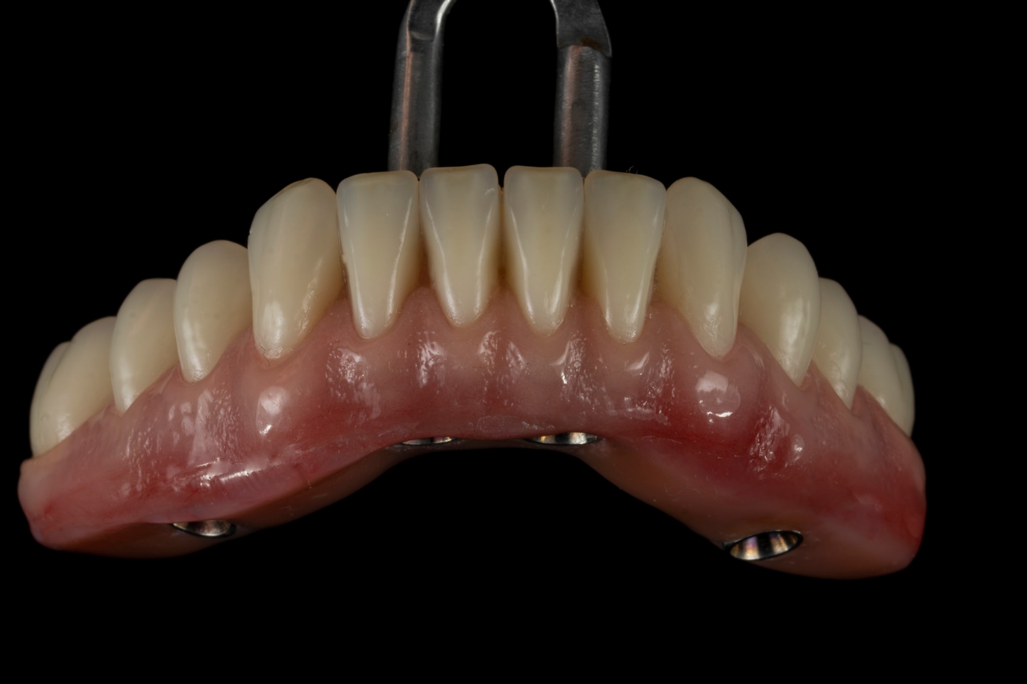 Odontotécnika Keyven LAB added... - Odontotécnika Keyven LAB