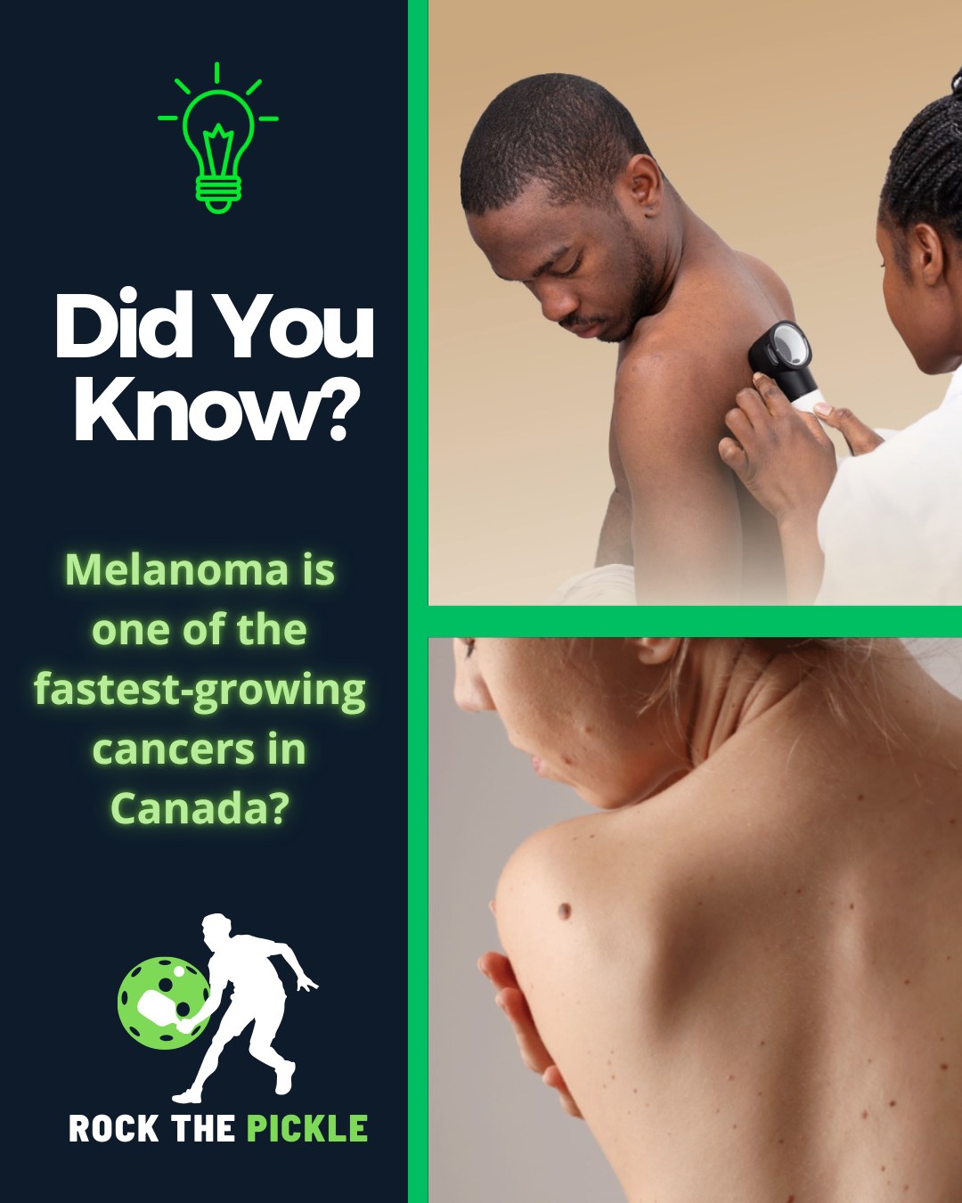 Rock - ☀️ We’re Playing to Fight Melanoma Did you know melanoma is one ...