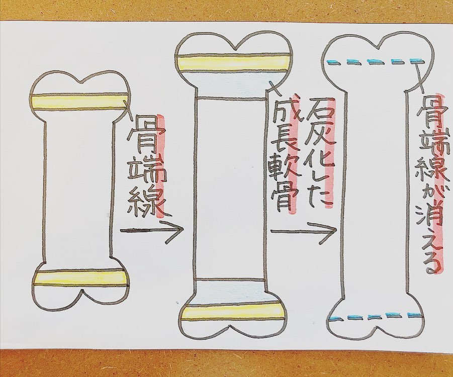 きらり整体整骨院 - 【ヒトの身体、人間の身体を知ろう】 身長はどうやって伸びるのか？ 成長期の腕や脚などの...