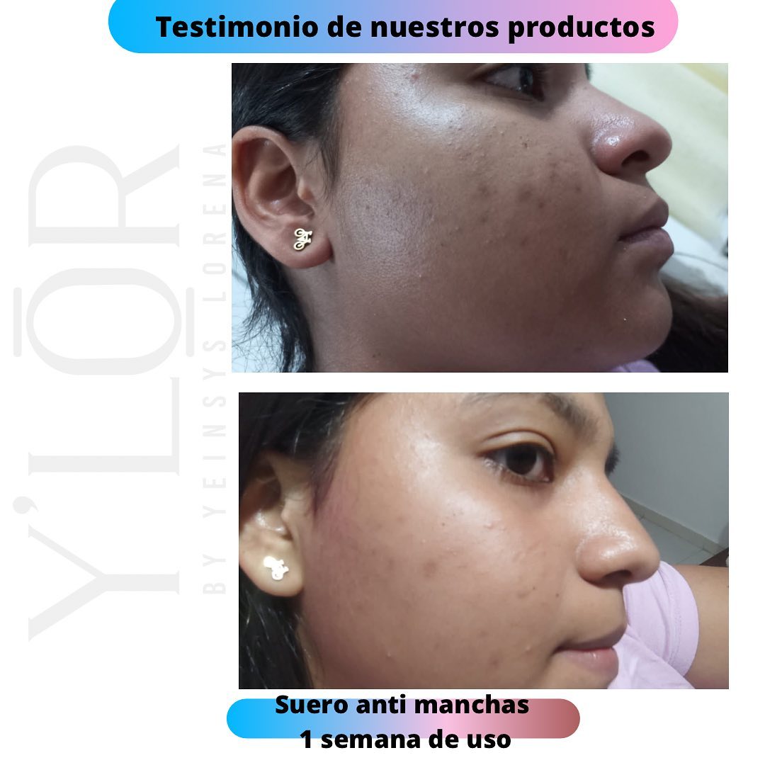 Ylor cosmetica - Nuevo testimonio, suero anti manchas,...