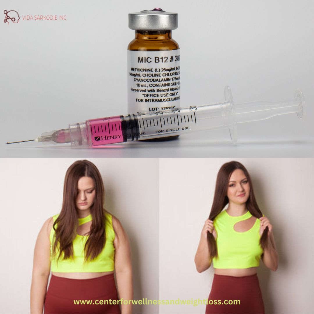 🥰Lipotropic(MIC) and B12 Injection HOMEKIT w/ TeleHealth Practitioner Consultation🥰 Are you tired of your fat body? Feel your life unbearable?? Then this information is for you. 👉 Procedure Intramuscular (IM) Injection, self-administered