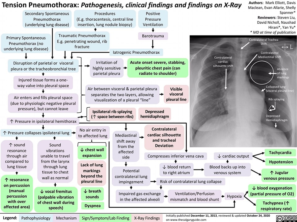 Algorithm on pathogenesis and x-ray... - Medical Information | Facebook