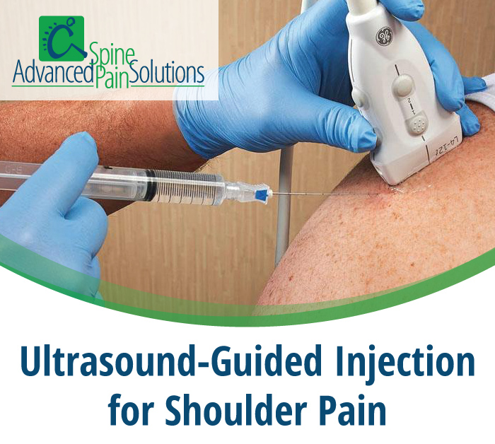 best place to inject klow Where for shoulder pain? Semaglutide with L-carnitine: guide I smoke Shade:22.5 Natural