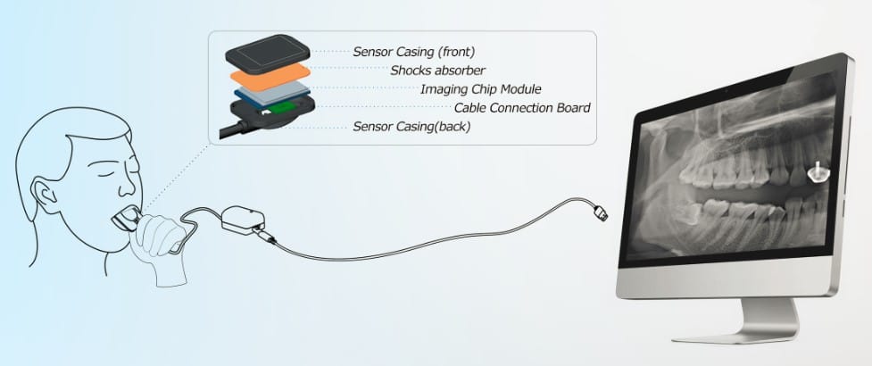 Microlife Technology - XLinearVision™Photon-Counting Intraoral X-Ray ...