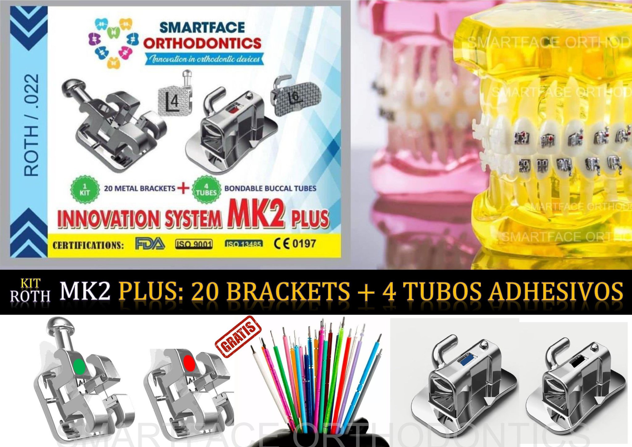👉🏻🦷 SUPER KIT ROTH : 20 BRACKETS +... - Ortodoncia del Perú | Facebook
