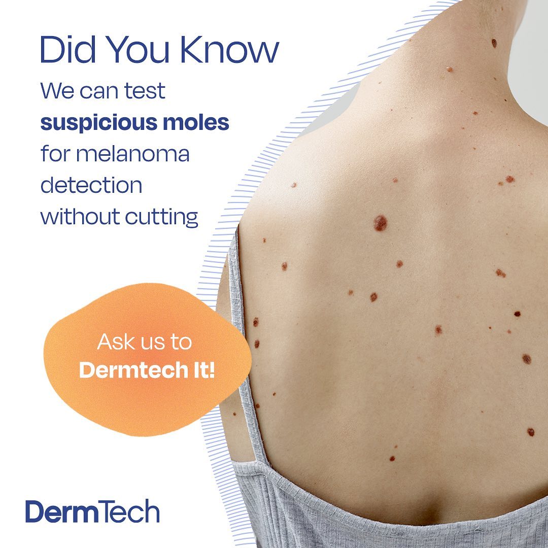 Central Park South Dermatology - Did you know? When melanoma is found ...