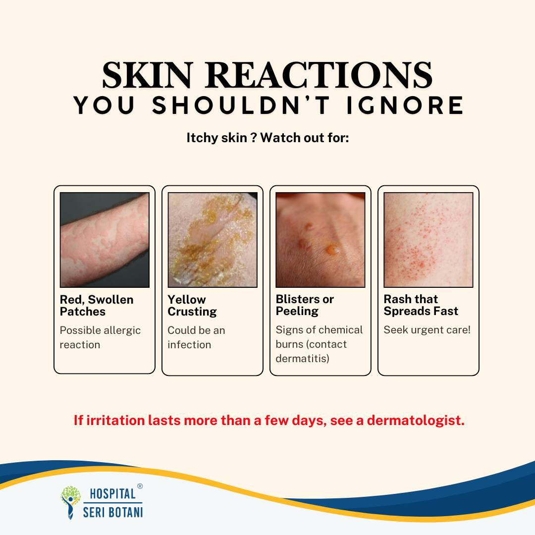 Hospital - Skin reactions can be more than just irritation! If symptoms ...
