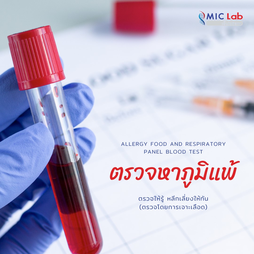 💁‍♀️ให้บริการเจาะเลือดต... - MIC Lab ห้องปฏิบัติการเอ็มไอซีแลบ | Facebook