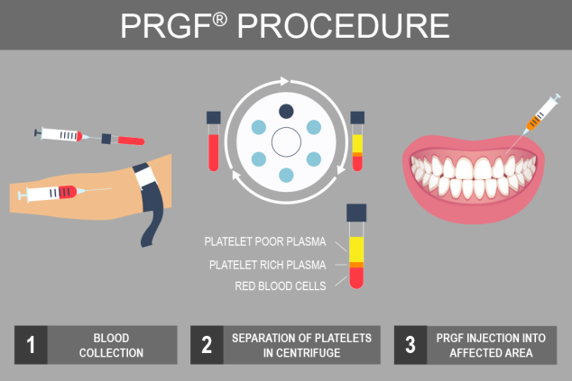 Phlebotomy - Ever wondered why dentists take blood?? The major effects ...