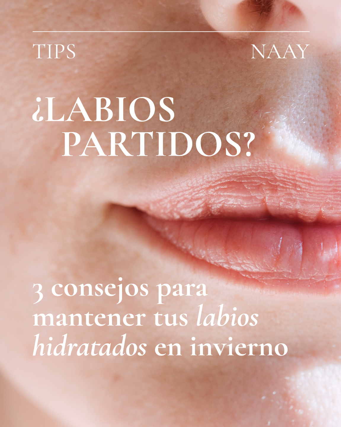 Naay Chile - La piel de los labios es delgada y delicada,... | Facebook