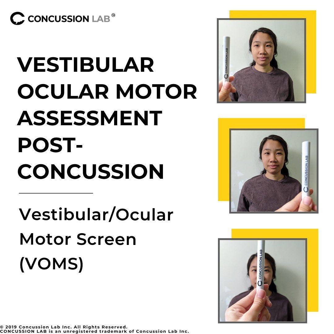 Dizziness is a common symptom... - Concussion Lab Inc | Facebook