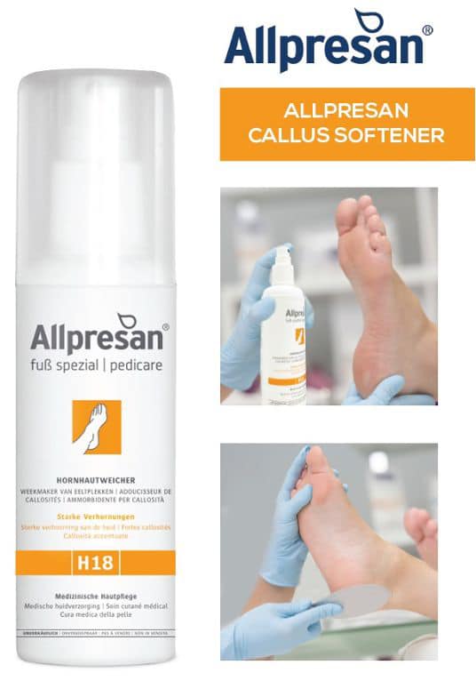 United - Strong acidic callus softener can break skin barrier which can ...