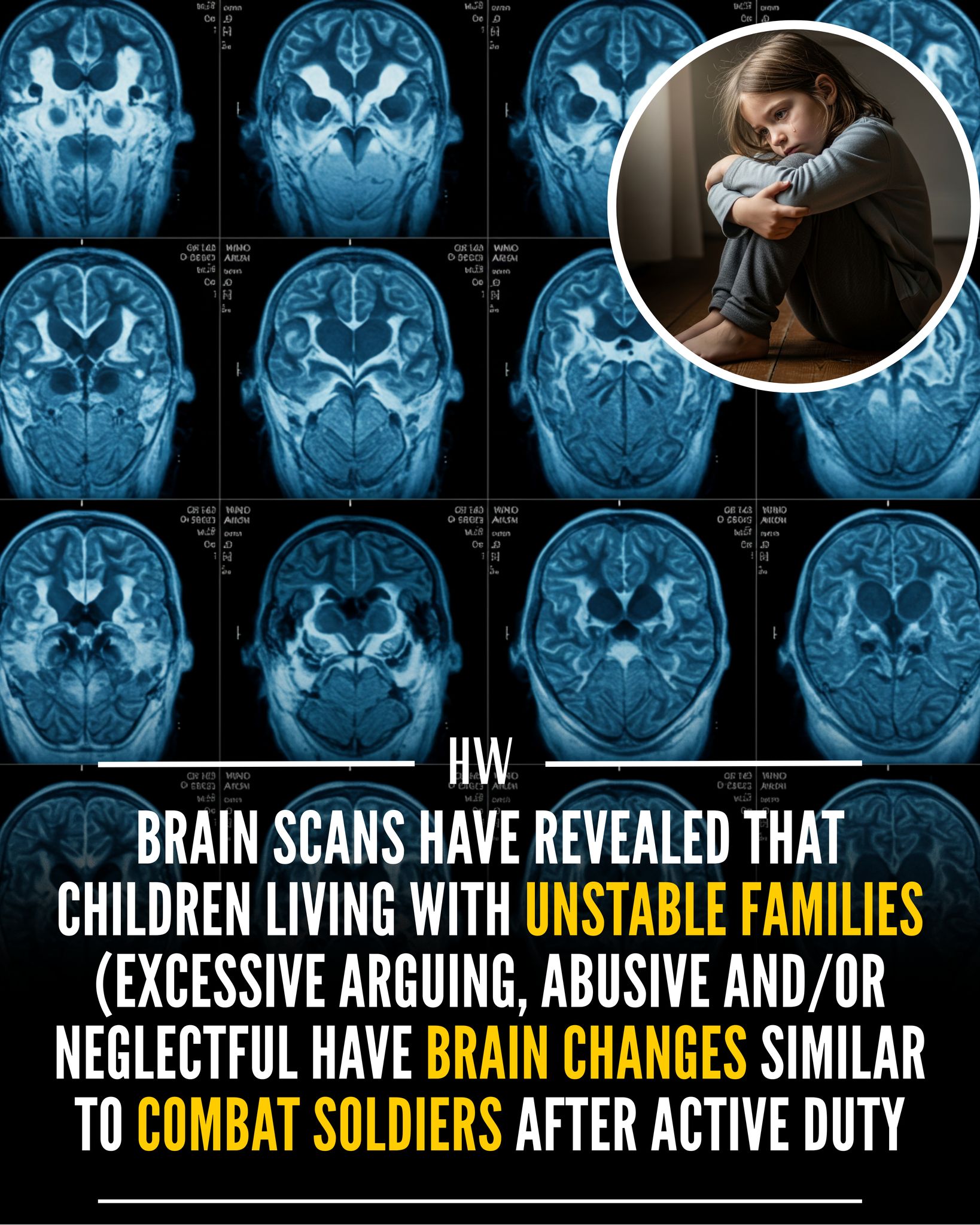 Honor.Walk - New brain scans show children exposed to chronic family ...