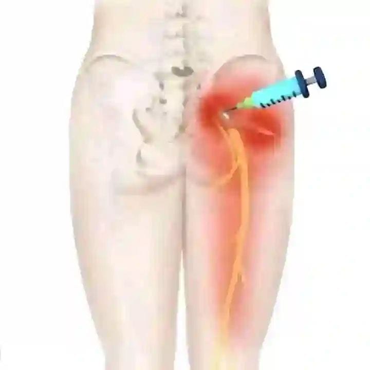 what happens if you inject b12 wrong is injected Need to Know About Vitamin Common Mistakes in B12 Injections  what happens if you inject
