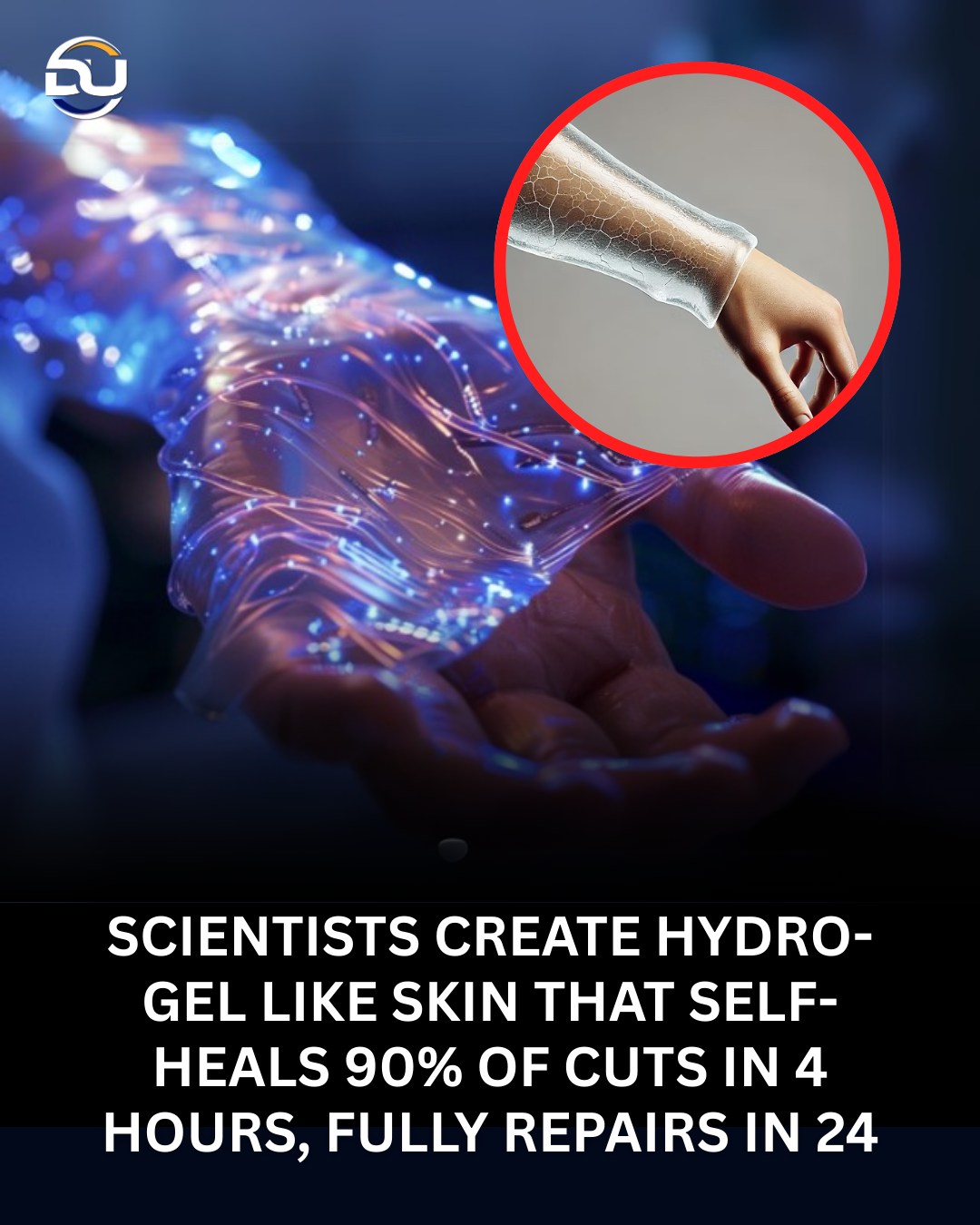 Discover - Skin That Heals Itself: The Hydrogel Breakthrough Mimicking ...