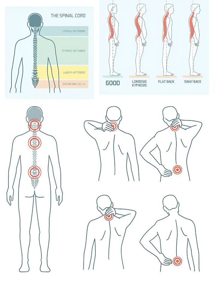Doctor - The Impact of Spinal Deformities on Chronic Back Pain Chronic ...